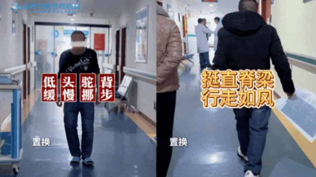 治愈实例 | 看视频！脊柱“冰冻”20年，福州“强直”患者重获行走自由